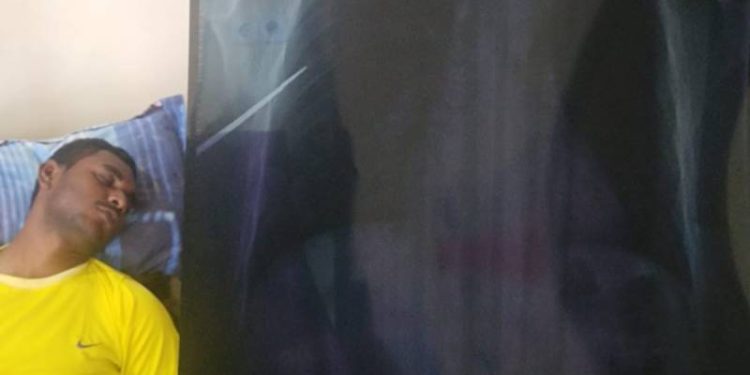 Penanganan Lebih Intensif, Anggota Polri Korban Panah Dogiyai Dirujuk ke RS Bhayangkara Jayapura